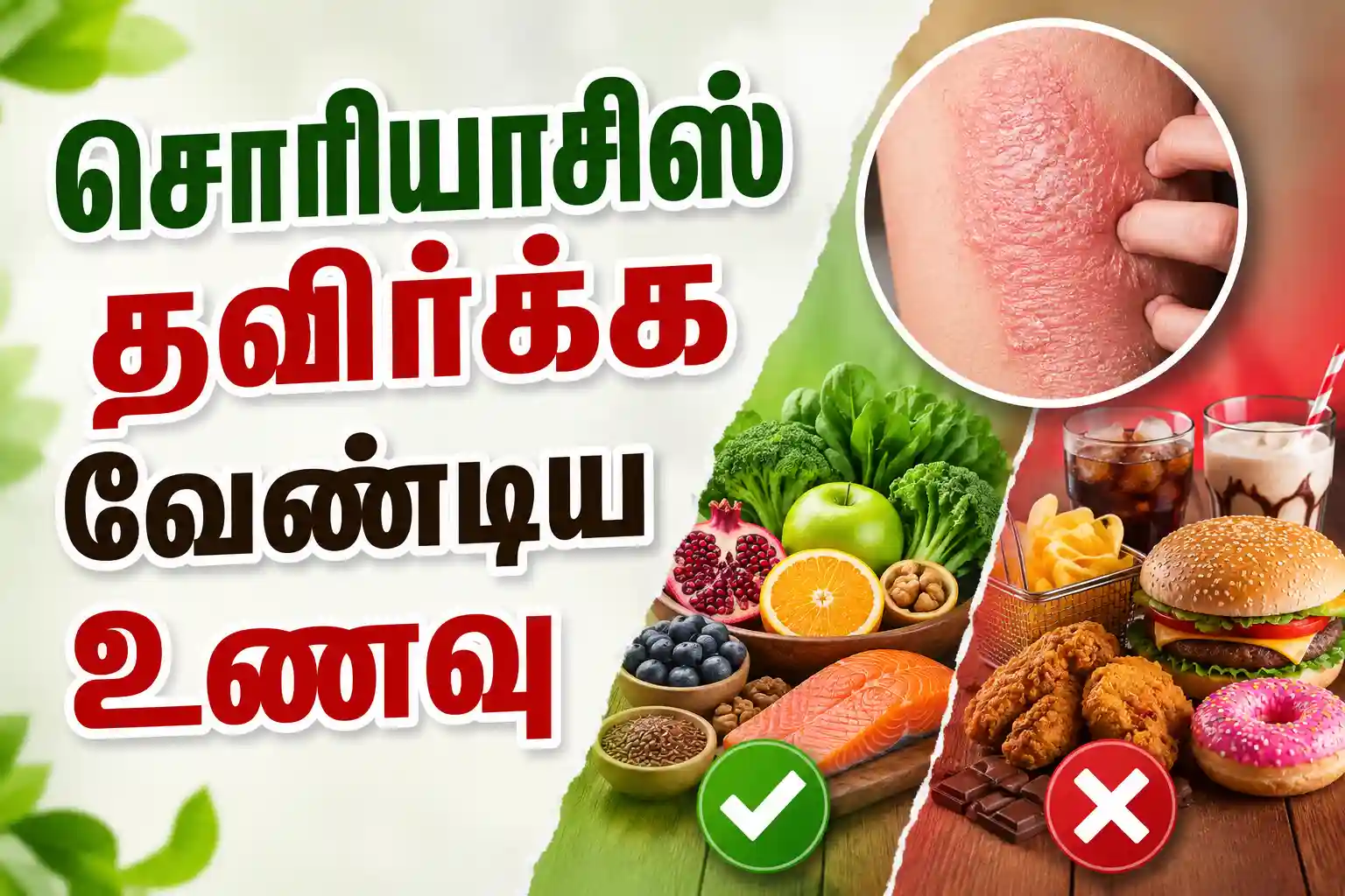 Psoriasis Diet in Tamil